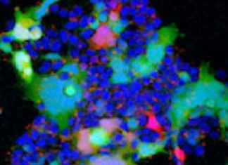 Covid-19: The BA.2 Subvariants With The Concerning Mutations L452Q – L452R Are Spreading Globally