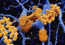 Measuring blood levels of P-tau181 may allow doctors to diagnose Alzheimer’s before the onset of symptoms