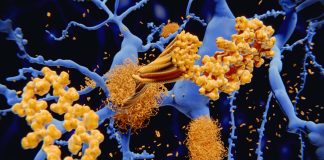 Measuring blood levels of P-tau181 may allow doctors to diagnose Alzheimer’s before the onset of symptoms