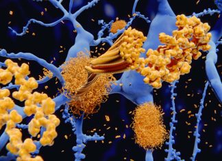 Measuring blood levels of P-tau181 may allow doctors to diagnose Alzheimer’s before the onset of symptoms