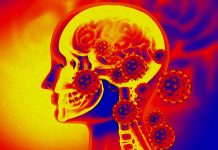 Majority Of Non-Hospitalized COVID-19 Infected Individuals Have Decreased Cerebral Blood Flow
