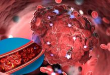 Most post COVID individuals have an abnormal blood clotting condition due to an elevated Von Willebrand Factor (VWF) antigen (Ag)