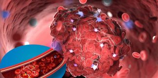 Most post COVID individuals have an abnormal blood clotting condition due to an elevated Von Willebrand Factor (VWF) antigen (Ag)