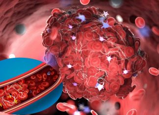 Most post COVID individuals have an abnormal blood clotting condition due to an elevated Von Willebrand Factor (VWF) antigen (Ag)