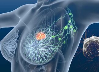 Lymph node targeted nanomedicine is the key to treating triple negative breast cancer