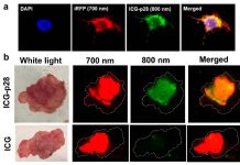 Tumor removal: Near-infrared light fluorescence ICG-p28 can accurately identify tumor margins cutting recurrence