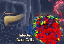 SARS-CoV-2 Directly Infects The Pancreatic Islets And Causes Pancreatic Inflammation