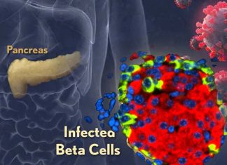 SARS-CoV-2 Directly Infects The Pancreatic Islets And Causes Pancreatic Inflammation