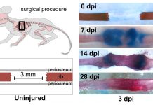 The Sonic hedgehog (Shh) gene is the key to repairing large bone injuries