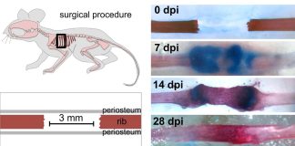 The Sonic hedgehog (Shh) gene is the key to repairing large bone injuries