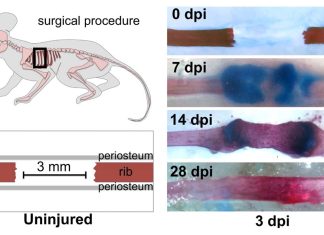 The Sonic hedgehog (Shh) gene is the key to repairing large bone injuries
