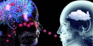 Il deterioramento cognitivo a causa di un grave COVID-19 equivale a perdere 10 punti QI