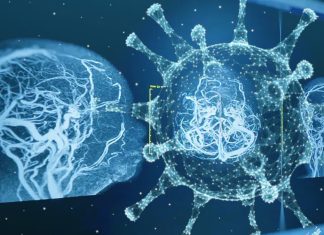 SARS-CoV-2 Infections Causes Widespread Prevalence Of Inflammatory Microvasculopathy In Brains Of Infected