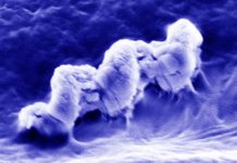 Nano-sized robots can help kill bacteria deep inside dentinal tubules