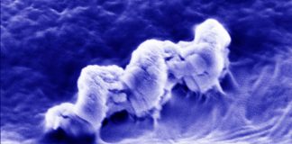 Nano-sized robots can help kill bacteria deep inside dentinal tubules