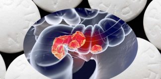 Cancro del colon-retto: l’aspirina riduce il tasso di divisione cellulare del tumore e aumenta il tasso di morte cellulare