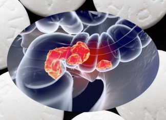 Cancro del colon-retto: l’aspirina riduce il tasso di divisione cellulare del tumore e aumenta il tasso di morte cellulare