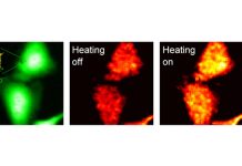 Alzheimer’s disease: the aggregation of amyloid-beta causes cells to overheat and fry like eggs