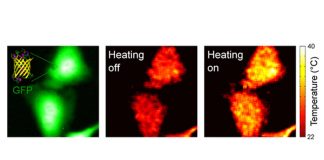 Alzheimer’s disease: the aggregation of amyloid-beta causes cells to overheat and fry like eggs