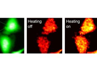 Alzheimer’s disease: the aggregation of amyloid-beta causes cells to overheat and fry like eggs