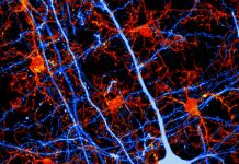 Long-Term Anti-Anxiety Drug Use Affects the Brain
