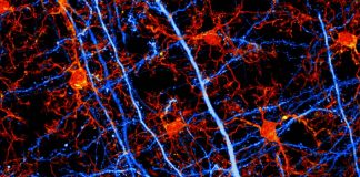 Long-Term Anti-Anxiety Drug Use Affects the Brain