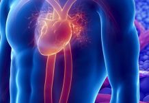 Heart Attack: METRNL stimulates vascularization and reduces scarring
