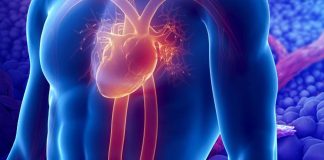 Heart Attack: METRNL stimulates vascularization and reduces scarring