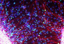 Motor neurone degenerative diseases are caused by abnormal lipid processing pathways inside brain cells