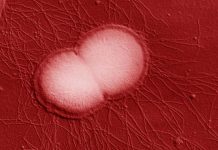 New Super Drug Resistant Strain Of Neisseria Gonorrhoeae Originating From South-East Asia Now Spreading In Europe