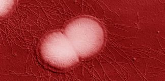 New Super Drug Resistant Strain Of Neisseria Gonorrhoeae Originating From South-East Asia Now Spreading In Europe