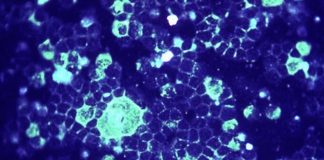 AVG-388 drug targets a key part of the respiratory syncytial virus (RSV)