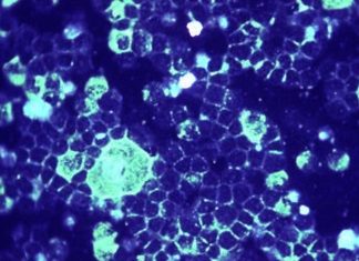 AVG-388 drug targets a key part of the respiratory syncytial virus (RSV)