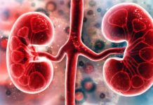 Millions of SARS-CoV-2 Infected Individuals Are Not Aware That They May Have Undiagnosed Acute Kidney Injury