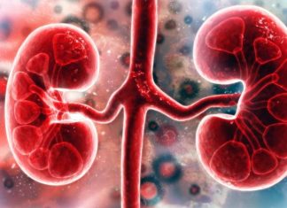 Millions of SARS-CoV-2 Infected Individuals Are Not Aware That They May Have Undiagnosed Acute Kidney Injury
