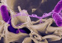 New Variant Of Salmonella ST34 Strain Causing New Outbreak In The U.S.