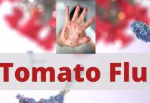 A new viral disease called Tomato Flu affects children in many states of India