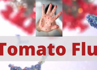 A new viral disease called Tomato Flu affects children in many states of India