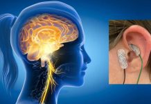 Transcutaneous Auricular Vagus Nerve Stimulation (taVNS) Therapy Can Help In Long COVID