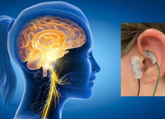 Transcutaneous Auricular Vagus Nerve Stimulation (taVNS) Therapy Can Help In Long COVID