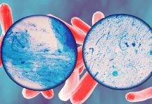 Tuberculosis: new highly sensitive blood test that screens for DNA fragments