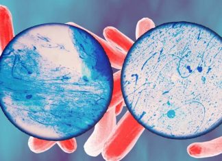 Tuberculosis: new highly sensitive blood test that screens for DNA fragments