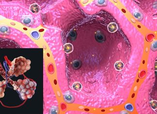 I lunghi sintomi debilitanti del COVID sono correlati ad anomalie microscopiche che influenzano il modo in cui l’ossigeno viene scambiato dai polmoni ai globuli rossi