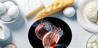 Men with higher intakes of dairy foods face a significantly higher risk of prostate cancer