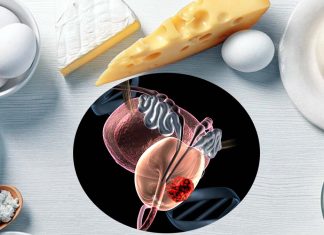 Men with higher intakes of dairy foods face a significantly higher risk of prostate cancer