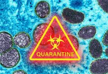 Tutto quello che devi sapere su Vaiolo e Monkeypox