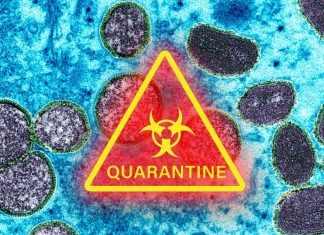 Tutto quello che devi sapere su Vaiolo e Monkeypox