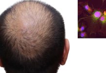 Regulatory T cells interact with skin cells using glucocorticoid hormones to generate new hair follicles and promote hair growth