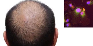 Regulatory T cells interact with skin cells using glucocorticoid hormones to generate new hair follicles and promote hair growth