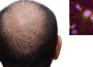 Regulatory T cells interact with skin cells using glucocorticoid hormones to generate new hair follicles and promote hair growth